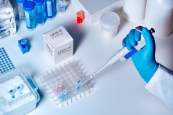 TESTELE PCR – COVID19