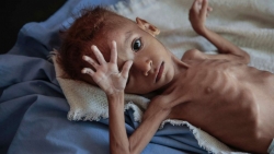 Yemen/BBC